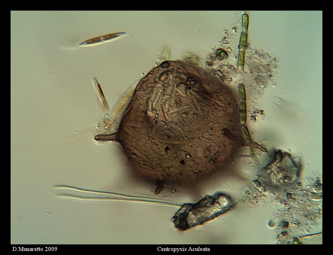 Centropyxis Aculeata